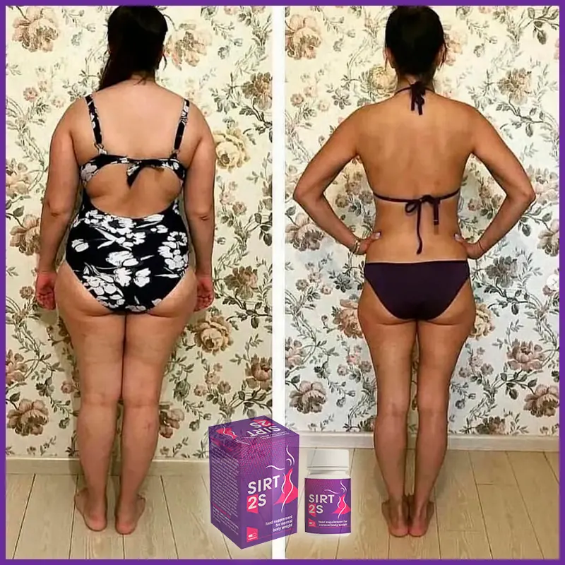 Sirt2S отзыв 10